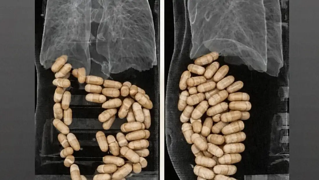 İzmir’de havalimanında uyuşturucu operasyonu: Midelerinden 1,3 kilo eroin çıktı