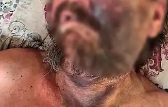 Abimin cenazesine neden gelmedin? dedi, feci şekilde dövdü