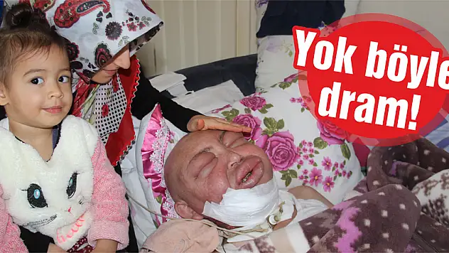 Yüzü şişiyor, vücudu eridi