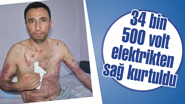 34 bin 500 volt elektrikten sağ kurtuldu