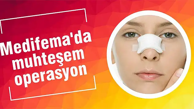 Estetikle burnunuz ömür boyu güzel olsun