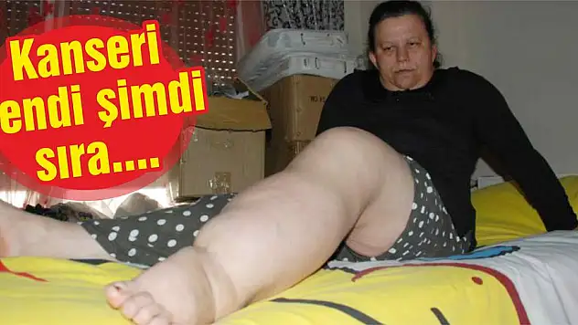 Kanseri yendi şimdi sıra…