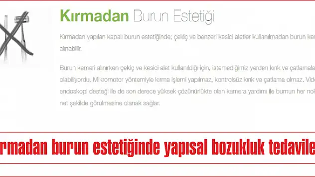 Kırmadan burun estetiğinde yapısal bozukluk tedavileri