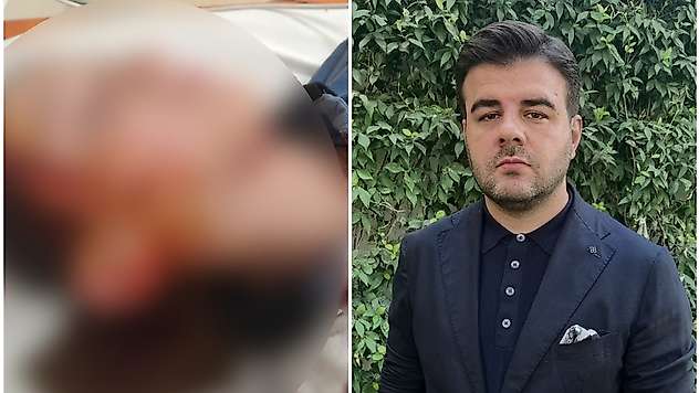 Köpek saldırısında 11 yaşındaki çocuğa 1 milyon 200 bin lira tazminat