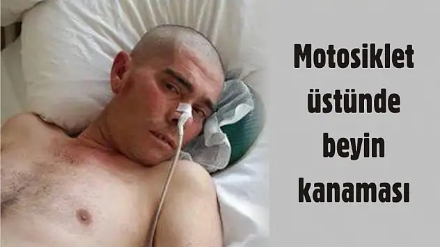 Motosiklet üstünde beyin kanaması