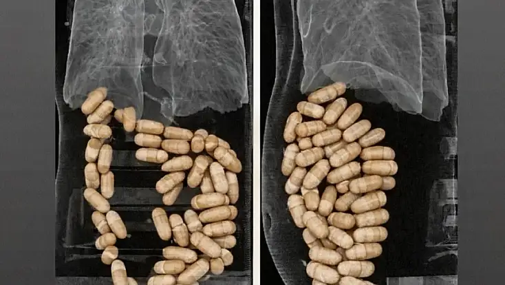 İzmir’de havalimanında uyuşturucu operasyonu: Midelerinden 1,3 kilo eroin çıktı